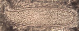 Pertusaria multipuncta image