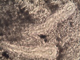 Pertusaria multipuncta image