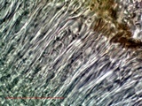 Candelariella rosulans image