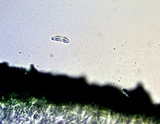 Candelariella rosulans image