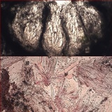 Pertusaria heterochroa image