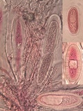 Pertusaria heterochroa image