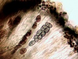 Buellia badia image