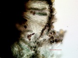 Buellia badia image