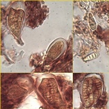 Arthonia pruinata image