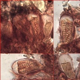 Arthonia pruinata image