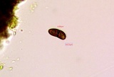 Amandinea punctata image