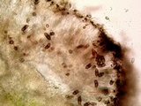 Amandinea punctata image