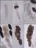 Hysterographium fraxini image