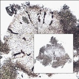 Rinodina atrocinerea image