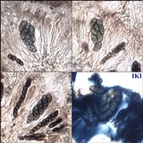 Rinodina fimbriata image