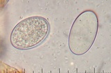 Morchella brunnea image