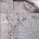 Lecanora chlarotera image