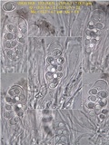 Lecanora chlarotera image