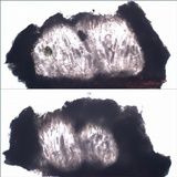 Pertusaria pustulata image