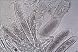 Pertusaria pustulata image
