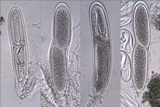 Pertusaria pustulata image