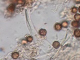 Scleroderma polyrhizum image