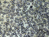 Porpidia albocaerulescens var. albocaerulescens image