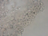 Xylobolus subpileatus image