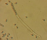 Peziza proteana f. proteana image