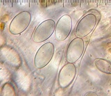 Geopyxis vulcanalis image
