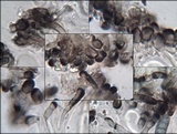 Diplotomma hedinii image