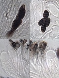 Diplotomma hedinii image