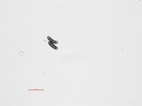Buellia triseptata image
