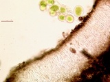 Amandinea punctata image