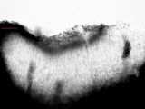 Amandinea punctata image