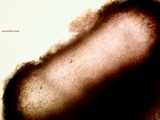 Amandinea punctata image