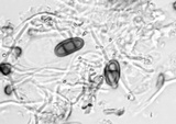 Amandinea punctata image