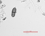 Amandinea punctata image
