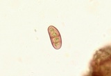 Amandinea punctata image