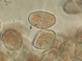 Cronartium quercuum image