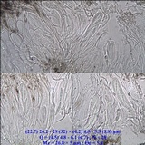Schismatomma graphidioides image