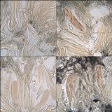 Schismatomma graphidioides image