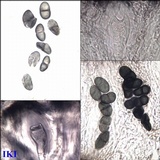 Rhizocarpon jemtlandicum image
