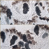 Rinodina capensis image