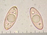 Gyromitra montana image