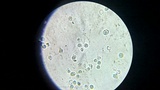 Leucopaxillus albissimus image