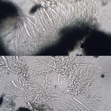 Skyttea pertusariicola image