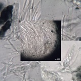 Skyttea pertusariicola image