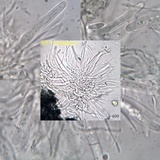 Skyttea pertusariicola image