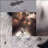 Pyrenula chlorospila image