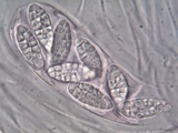 Julella vitrispora image