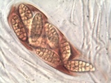 Julella vitrispora image