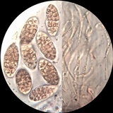 Julella vitrispora image