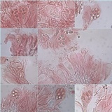 Pyrrhospora quernea image